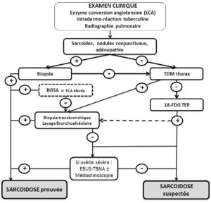Sarcoidose_Algorithme_pour_le_diagnostic_des_uveites_sarcoidosiques