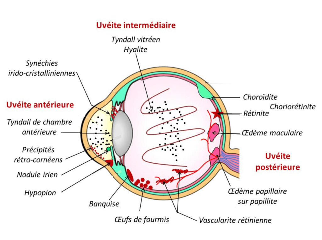 Sch ma Fond D Oeil L Assurance Maladie URNXVA