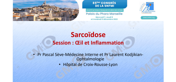 Sarcoïdose – Session : Œil et Inflammation