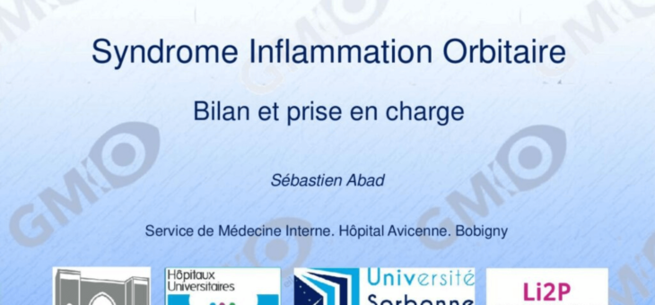 Syndrome Inflammation Orbitaire Bilan et prise en charge